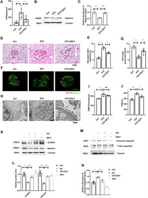 SS31 Ameliorates Podocyte Injury via Inhibiting OMA1-Mediated Hydrolysis of OPA1 in Diabetic Kidney Disease